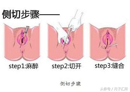 宫口开十指大概是几厘米,宫口开十指对应多少公分