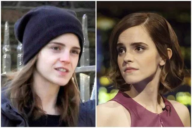 美女与野兽|天生法令纹只能靠整容吗?那是因为你没看这篇!