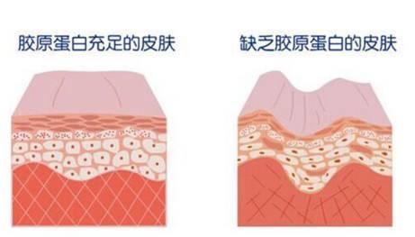 抗衰热拉提,热拉提抗衰祛皱精华液