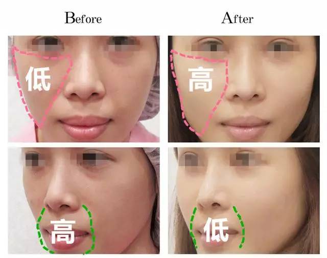 美女与野兽|天生法令纹只能靠整容吗?那是因为你没看这篇!