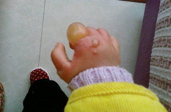 宝宝发烧39.8头很烫很烫怎么办,宝宝再也不怕被烫到了