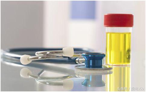 尿液发黄是不是有疾病,尿液发黄代表身体有炎症么