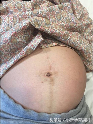 分娩日记二胎,分娩日记100篇