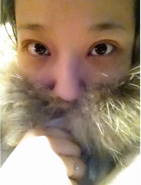 完美的埋线双眼皮,完美双眼皮