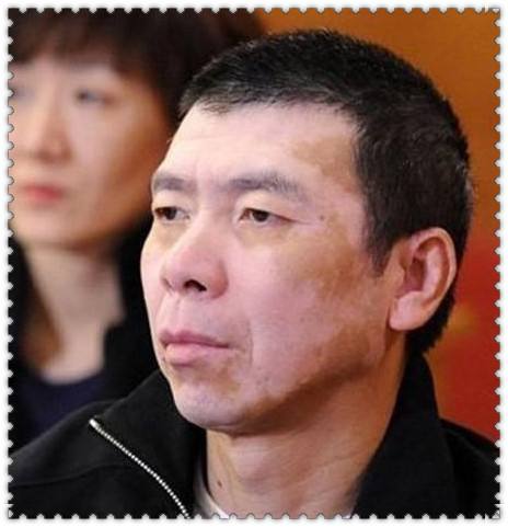 有什么方法快速治好白癜风,大家看白癜风都用哪些药