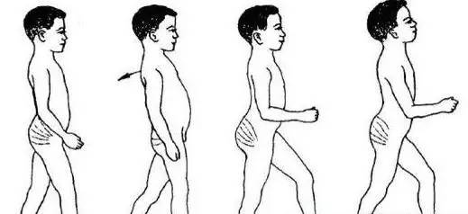 小腿结构图示图片,小腿骨骼构造示意图