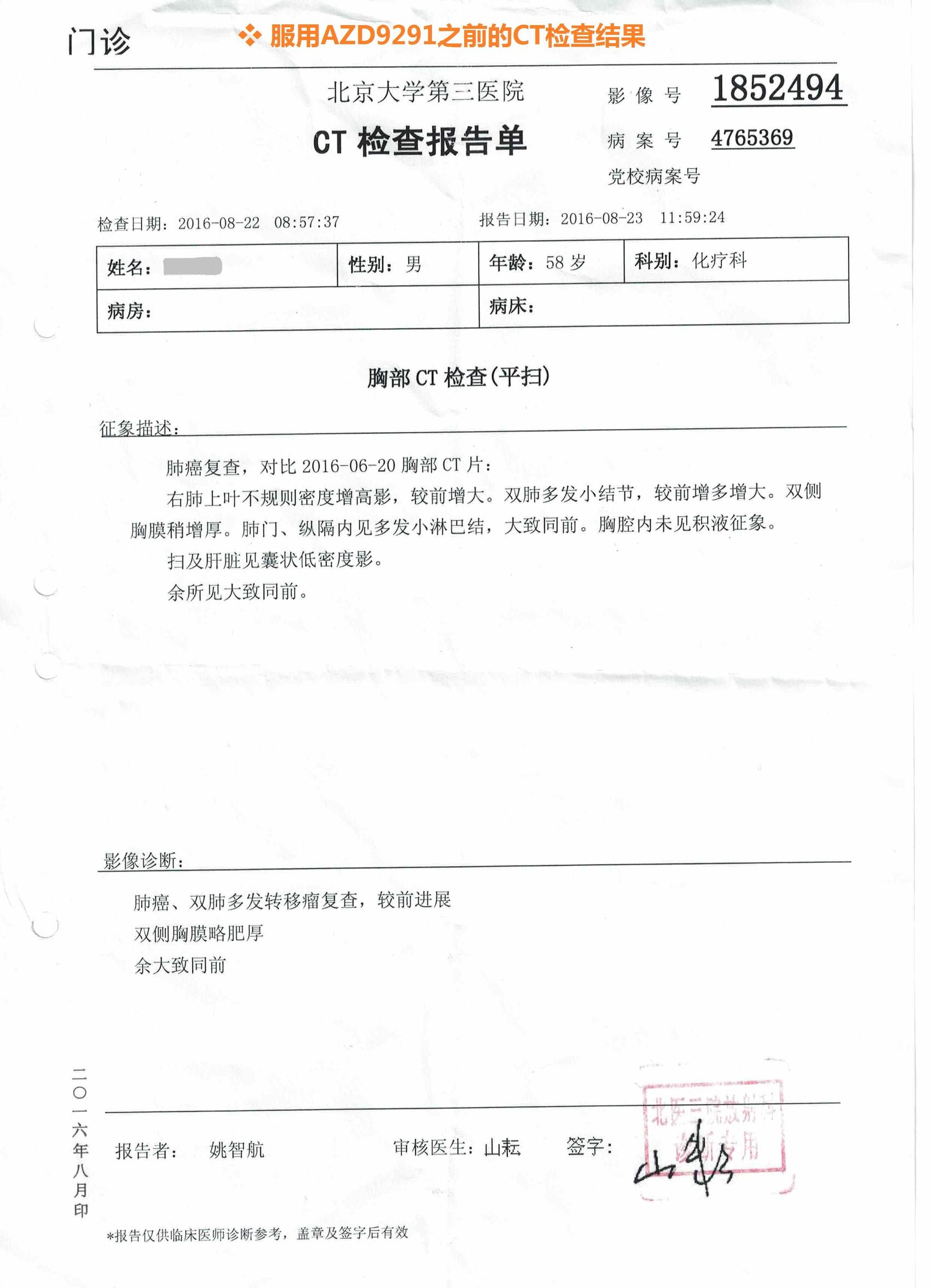 azd9291奥希替尼,azd9291中国购买价格