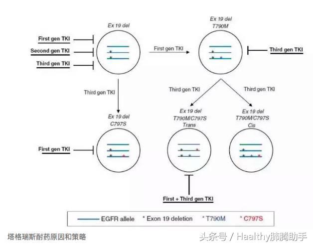 泰瑞沙靶向药服用两年后免费,2023靶向药泰瑞沙价格