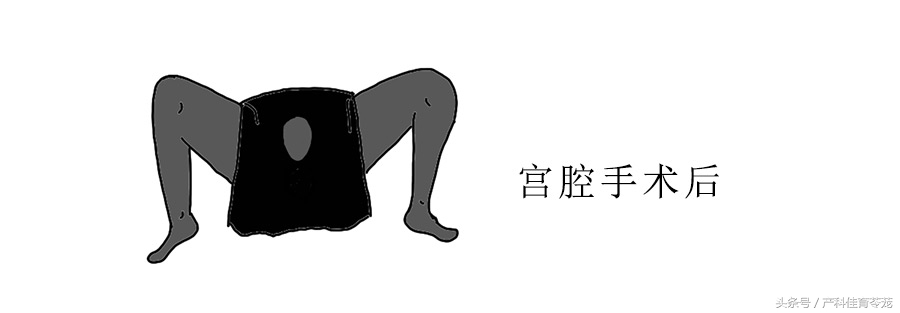 治疗盆腔炎要趁早！不然有大事发生