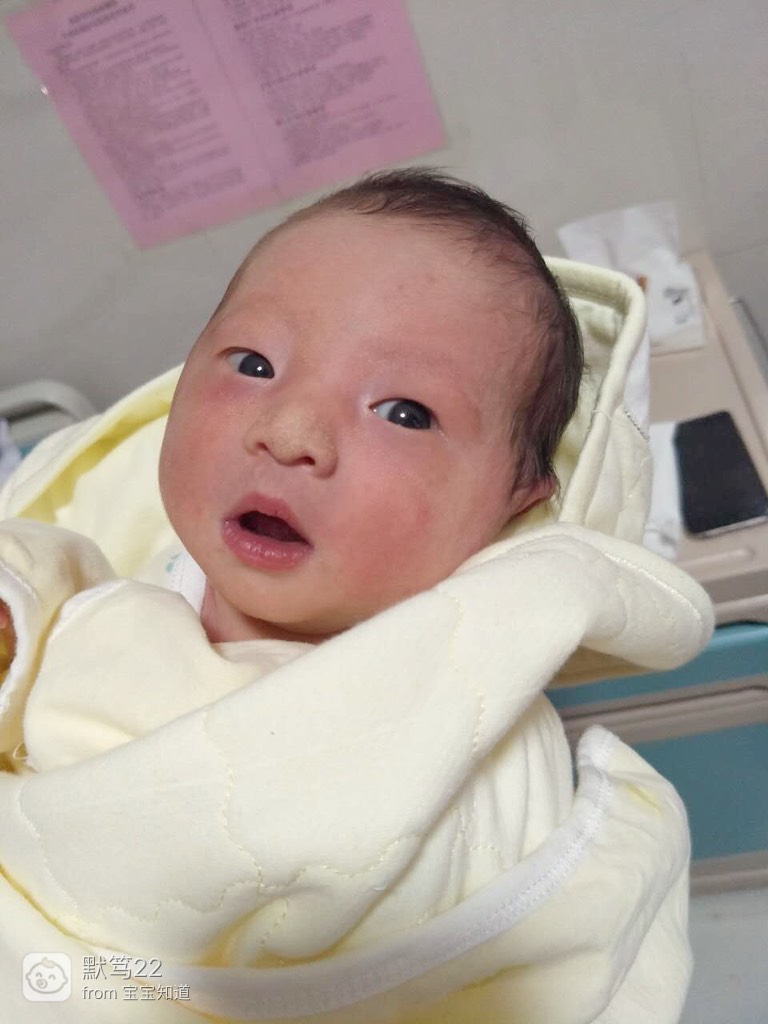 挂催产素怎么超快开宫口,挂催产素了破水了一般多久生