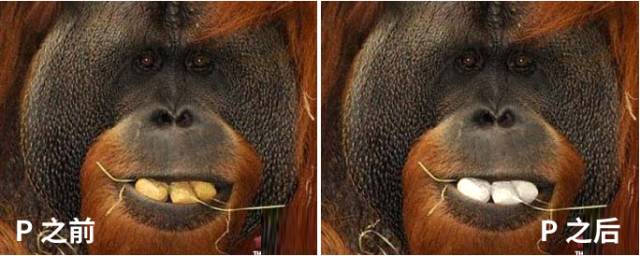 洗牙和美白牙齿能同时进行吗,洗牙使用什么牙膏美白牙齿