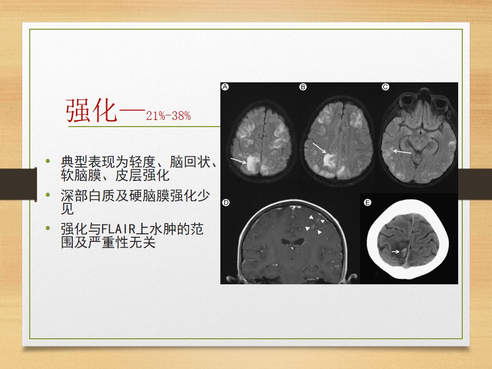 可逆性后部白质脑病综合征中央型,可逆性后部白质脑病综合征啥症状