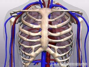 胸出口综合征诊疗标准,胸出口综合征的理疗办法