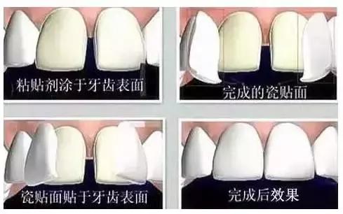 有多少明星整了鼻子,整过的明星有哪些