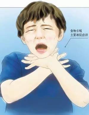 异物卡喉急救中医会怎么救,异物卡喉海姆立克急救法