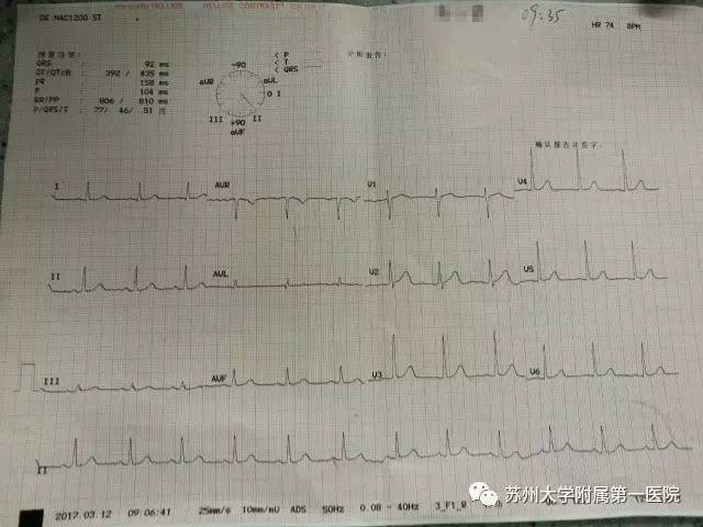 你以为只是一过性眼前发黑？这黑朦，一不小心蒙你没商量！