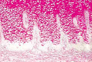 内镜做病理分析大概多久,作为一个医生太感性怎么办