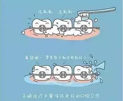 牙齿矫正打骨钉后注意事项,牙齿矫正需要注意的事项