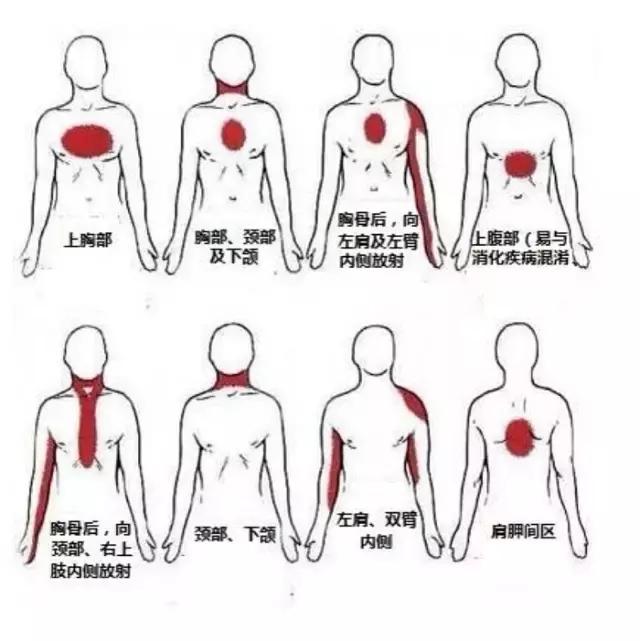 名中医王清海：警惕隐性冠心病预警信号，切勿忽视这些部位的疼痛