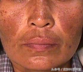 <html>
<head><title>502BadGateway</title></head>
<body>
<center><h1>502BadGateway</h1></center>
<hr><center>nginx</center>
</body>
</html>
<!--apaddingtodisableMSIEandChromefriendlyerrorpage-->
<!--apaddingtodisableMSIEandChromefriendlyerrorpage-->
<!--apaddingtodisableMSIEandChromefriendlyerrorpage-->
<!--apaddingtodisableMSIEandChromefriendlyerrorpage-->
<!--apaddingtodisableMSIEandChromefriendlyerrorpage-->
<!--apaddingtodisableMSIEandChromefriendlyerrorpage-->
