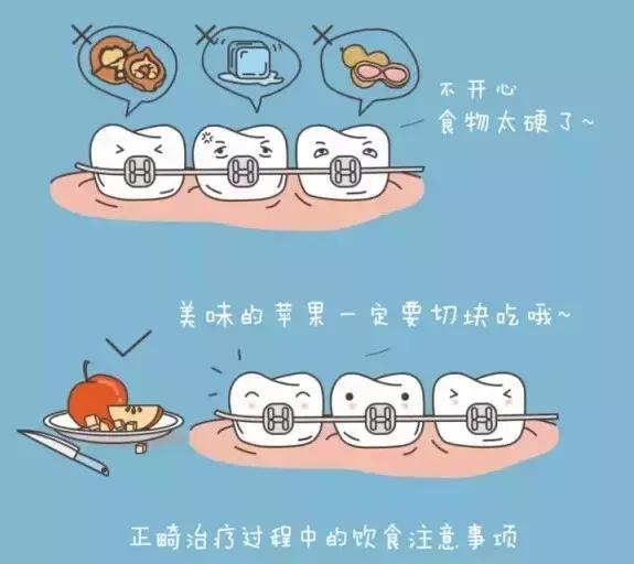 牙齿矫正打骨钉后注意事项,牙齿矫正需要注意的事项