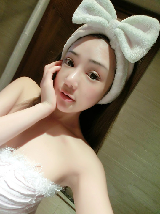 玻尿酸多少钱一支填充,玻尿酸多少钱一瓶图片