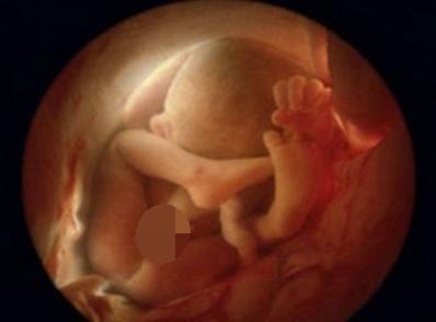 怀孕7个月下体偶尔有血迹,怀孕5个月下腹流血怎么办