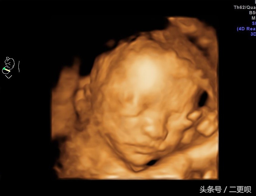 四维大排畸没有顺利通过，婆婆整天逼着叫做决定，快崩溃了……