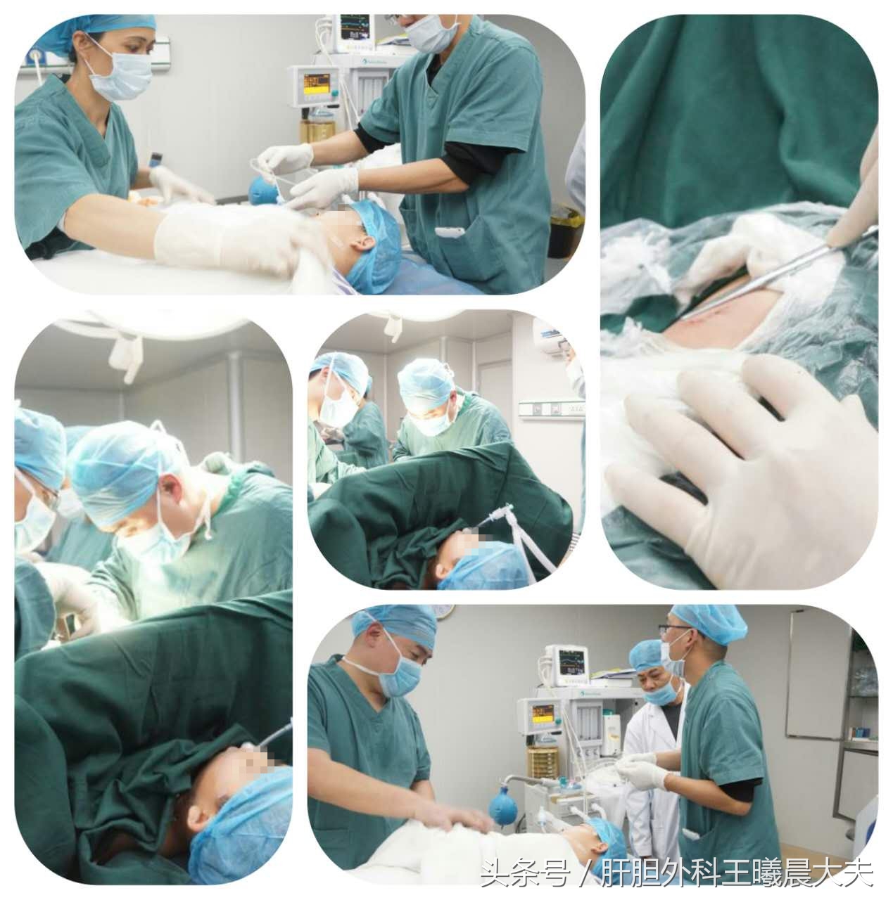 胆结石的危险因素不包括年龄性别,胆结石风险标识