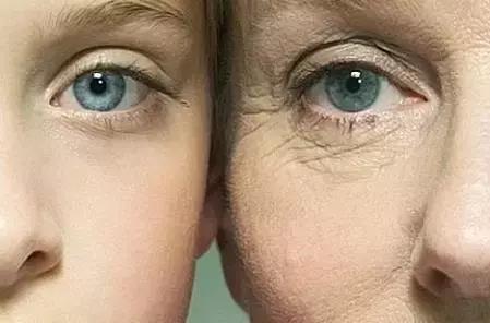 不用眼霜后果,不用眼霜的人注定老得快