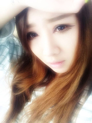 双眼皮手术后修复视频,双眼皮手术恢复记录视频