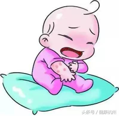 母乳婴儿起湿疹妈妈应该忌口什么,宝宝吃母乳长湿疹大人需要忌口吗