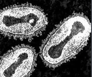 世界十大瘟疫对人类造成的伤害,人类历史上的十大病毒瘟疫