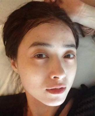 长痘憋怕有涛姐陪着你呐