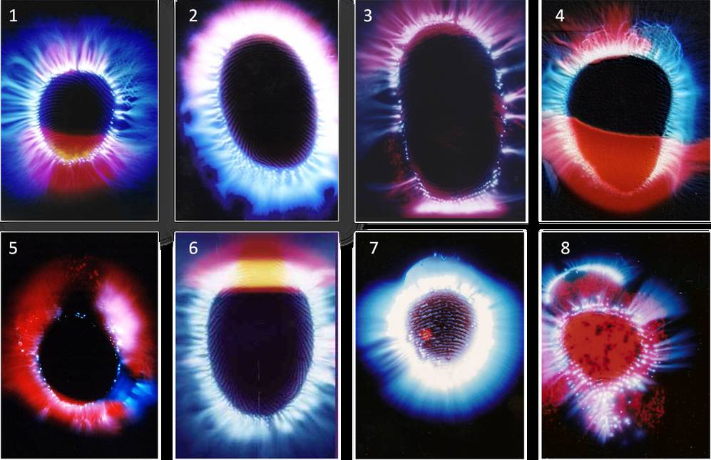 神秘光波的另类治疗法｜克里安摄影术