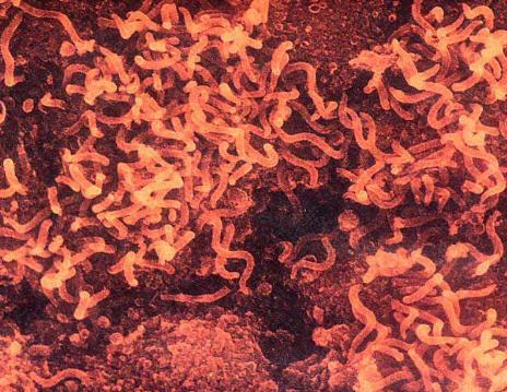 世界十大瘟疫对人类造成的伤害,人类历史上的十大病毒瘟疫