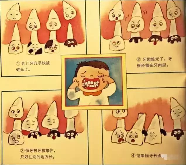 乳牙到底要不要根管治疗,儿童乳牙是全部要换的吗