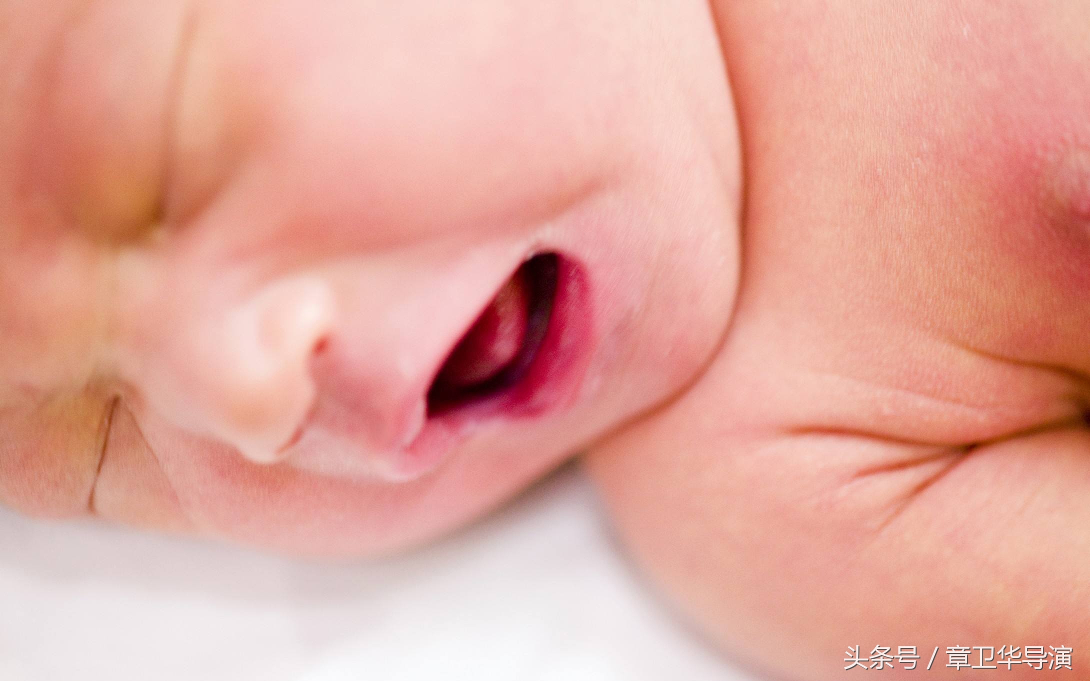 新生儿黄疸跟宝妈饮食有关系吗,新生儿黄疸持续多久会造成脑损伤