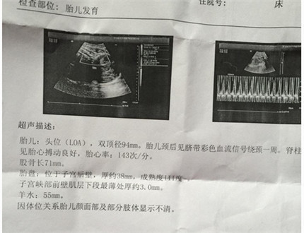 吃钙片会引起胎盘老化吗,吃钙片会加重胎盘成熟度吗