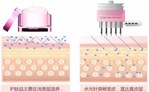 少女灯泡肌,灯泡肌美肤