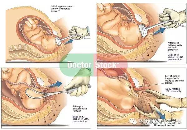 咪私料｜我的德国育儿日记之：产前夫妻培训课程（1）