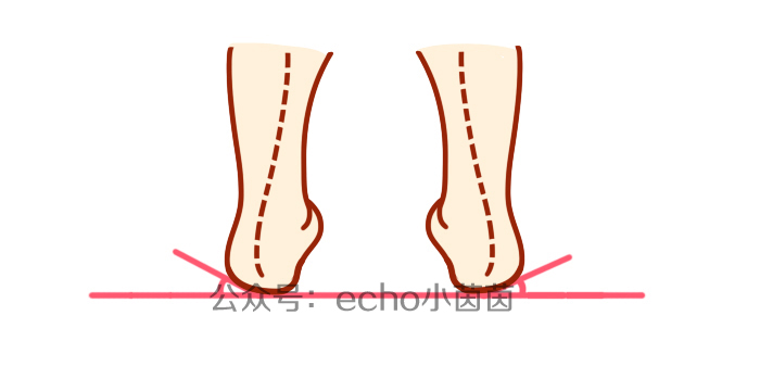 宝宝鞋底哪边磨得最厉害？背后问题没那么简单！