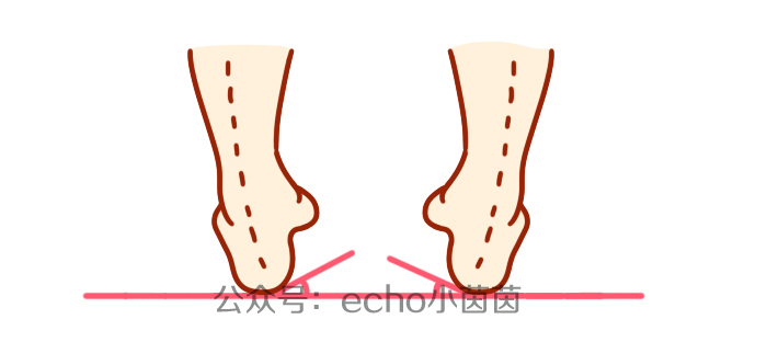 宝宝鞋底哪边磨得最厉害？背后问题没那么简单！
