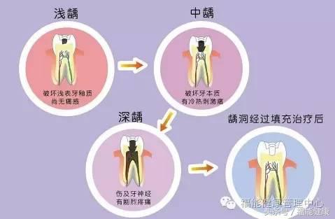 不爱吃甜食为什么会有虫牙,不爱吃甜的为何会糖尿病