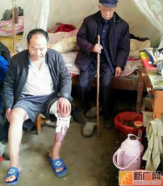 彝族村民李增贵烤贾酒盼脱贫遇火灾，栽多少包谷才能抚平49%烧伤