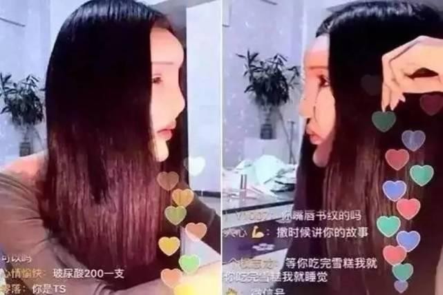 一眼就秒杀刘梓晨的“鱼精女”，看她整容后的脸感觉今晚会做噩梦