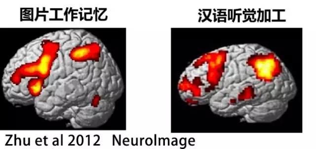 老年痴呆可以打麻将吗,玩麻将是不是可以防止老年痴呆