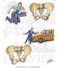 共享单车骑出的“骑跨伤”，需要尽快妇科就医手术！