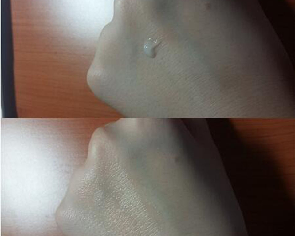 耳朵脖子后面长痘痘怎么办,脖子后面长痘痘一碰就疼