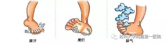 每天都汗如雨下,每天汗如雨下好不好